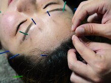 国際通りの朗らか鍼灸院