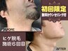 【初回限定/メンズ脱毛】¥5,980→¥1,000ヒゲまるごとメンズヒゲ脱毛◆