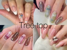 トゥリートップ(Treetop)