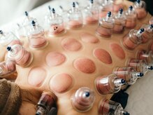 ホヌオラ(Honu Ola)/リピーター続出のカッピング！