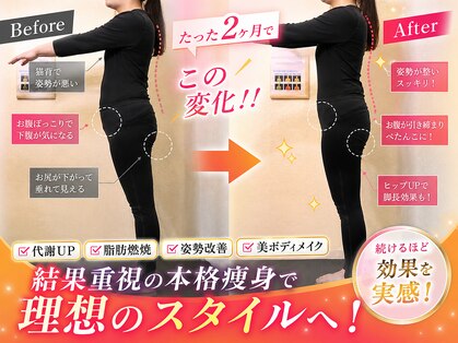 ヨサパーク ヴィラ デ ミューズ(yosa park villa des Muses)の写真