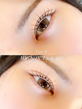 ミニョン(MIGNON)/MIGNONラッシュリフト