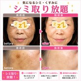 ココスタイルビューティー(COCOSTYLE beauty)