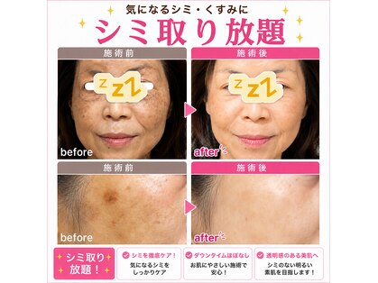 ココスタイルビューティー(COCOSTYLE beauty)の写真