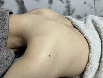 ジョリー ベル(Jolie Belle)の写真/【女性専門脱毛サロン×プライベート空間】総コストを抑えてウルツヤ美肌になりたいならJolie Belleに☆