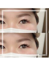 ナイン ゴー(Nine go)/バインドロック