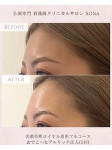 ソナ 大和西大寺院(SONA)/