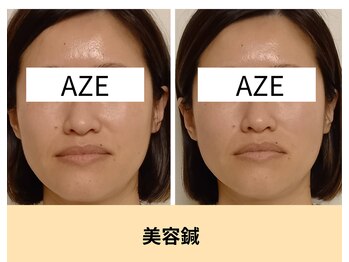 鍼灸院アゼ(AZE)/お顔の変化