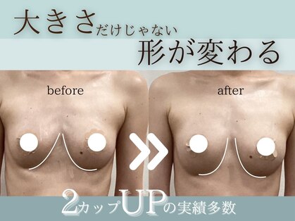 ムゲットの写真