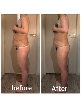 ユルリラ イロ(yururira iro)/全身痩身120分