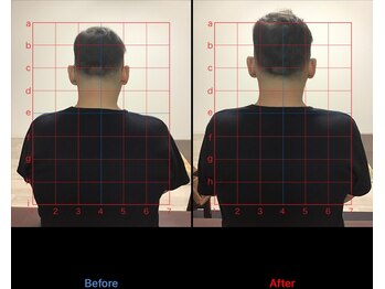 ストレチックス 近江八幡店/腰痛改善ビフォーアフター