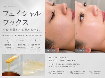 ラキ(LAKI)の写真