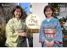 リザテラ(Rizaterra)の雰囲気（過度な食事制限、激しい運動なしでサイズダウン！(耳つぼ/痩身)）