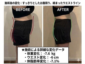 くによし整体院の写真/【本気で変えたい方限定】30-50代の減量実績多数!遺伝子検査×マンツーマンのコーチングで短期集中