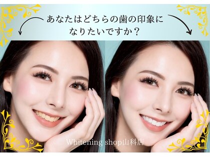 ホワイトニングショップ 山科店の写真