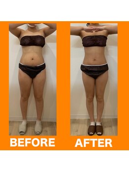 ぱるむ八幡西美容整体院/☆産後ダイエット☆