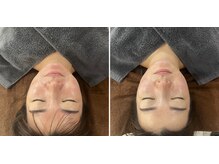 a.o.eの雰囲気（オーダーメイド90分一回の効果←左ビフォー：アフター右→）