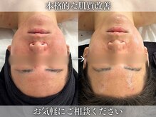 フェイシャルヴィム(FACIAL VIM)の雰囲気（肌質改善に自信あり♪お悩み別◎マシン×陶肌トリートメント）