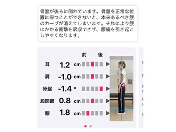 ナオル整体 大里院(NAORU整体)/AI姿勢診断【イメージ像】