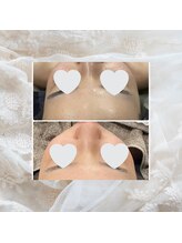 ディアー(Dear)/フェイシャル