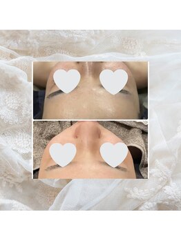 ディアー(Dear)/フェイシャル