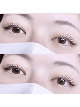 フィールリファイン(Feel Refine)/ラッシュリフト(上)