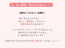 エクシアホワイトニング 札幌中島公園店/豆知識［ホワイトニング］
