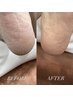 【FOOT】極上つるすべ踵ケア☆スパルーチェ使用＊