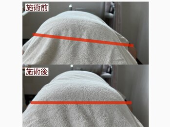 ティーズルーム(T's Room)/骨盤の歪みを整える