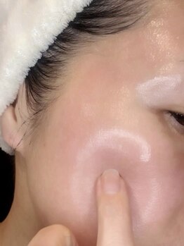 ミヨン(Miyong)の写真/【土台から引き締め×ハリつやUP】深層アプローチで理想の小顔へ。大人女性のお肌の悩みトータルケア♪