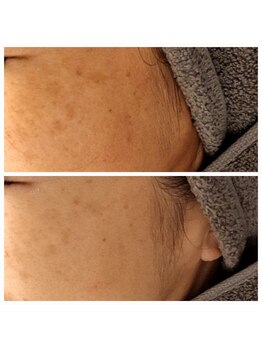 エリン(ERIN)/セラピール