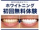 ブルーグロウ(Blue Glow)の写真