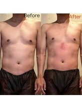 アリッチ 岡崎店(a.Rich)/脂肪燃焼コース90分1回驚き変化!