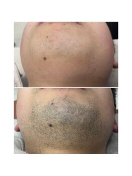 エリクサー 太田店(Elixir)/before after