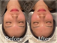 R-1ビューティーサロン 表参道/Before&After
