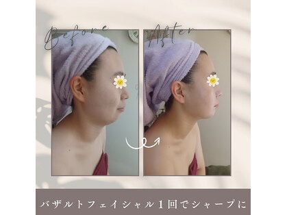 プライベートエステ カモミールの写真