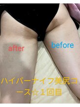 サロンドリドミ 新瑞橋店(Salon de ridomi)/ハイパーナイフボディ下半身