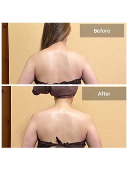 プライベートサロン アール(R)/肩こり・背中こりにもおすすめ