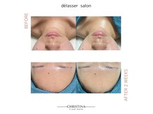 デラッセ サロン ギンザ 藤枝店(Delasser salon GINZA)の雰囲気（最先端！エイジングケアのクリスティーナニュアンス）