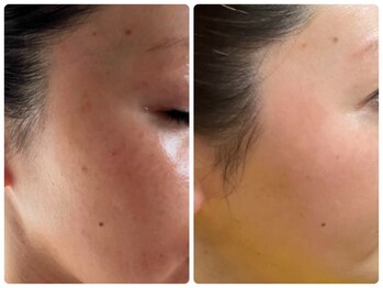 ベルドア(Bell Door)/ビタミンAってこんなに変わる！