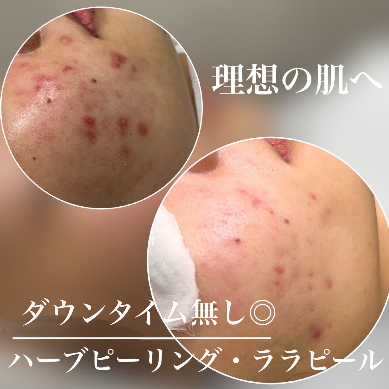 モモ(Momo.)｜ホットペッパービューティー