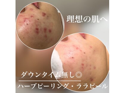 モモ(Momo.)の写真