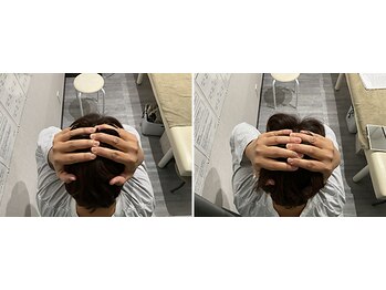 はぐみの杜整骨院 本院/【トータル小顔】頭蓋骨顔面整体