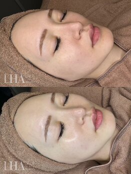 カノン 南熊本店(Kanon)/