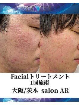 メンズサロンアール(AR)/プロセルセラピーズフェイシャル