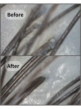 ストリクス(STRIX)/本来の頭皮へリセット