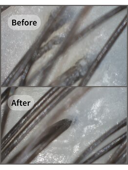 ストリクス(STRIX)/本来の頭皮へリセット