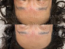 ハナワクシングプラス 高知(HanaWaxing+)/【年齢肌のためのワックス】