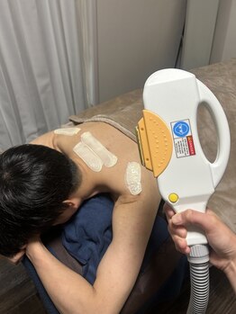 カナウ(KANAU)/硬毛化対策も徹底してます！