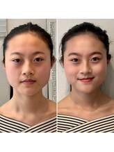 エイジレスビューティーアカデミー(Ageless Beauty Academy)/学生でも垢抜ける